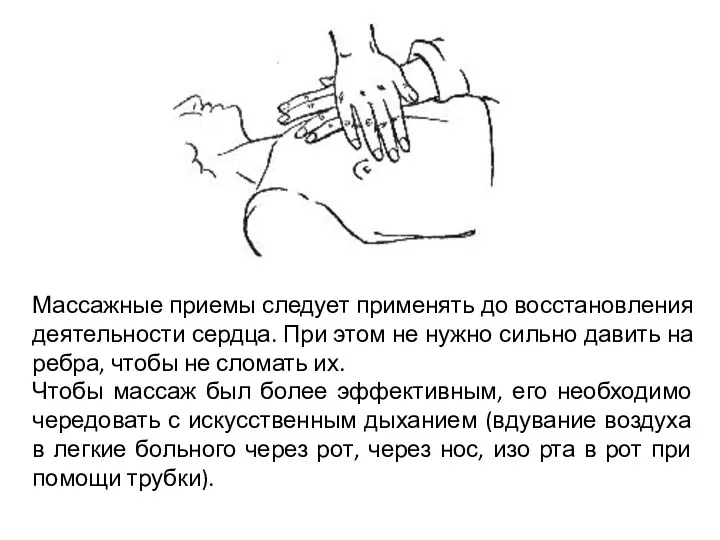 Массажные приемы следует применять до восстановления деятельности сердца. При этом