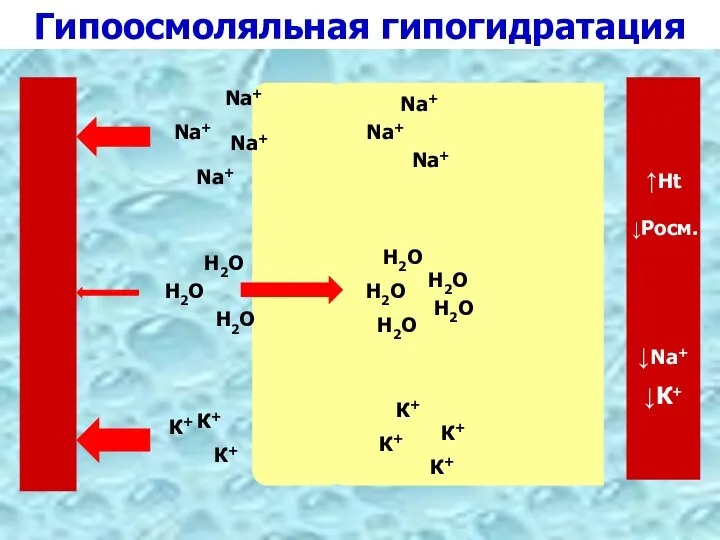 Гипоосмоляльная гипогидратация К+ Na+ Н2О К+ Na+ Н2О Н2О Н2О