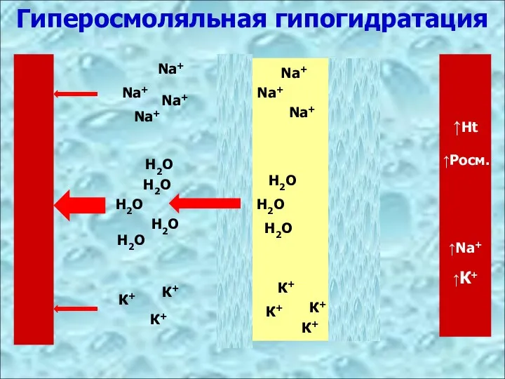 Гиперосмоляльная гипогидратация К+ Na+ Н2О К+ Na+ Н2О Н2О Н2О