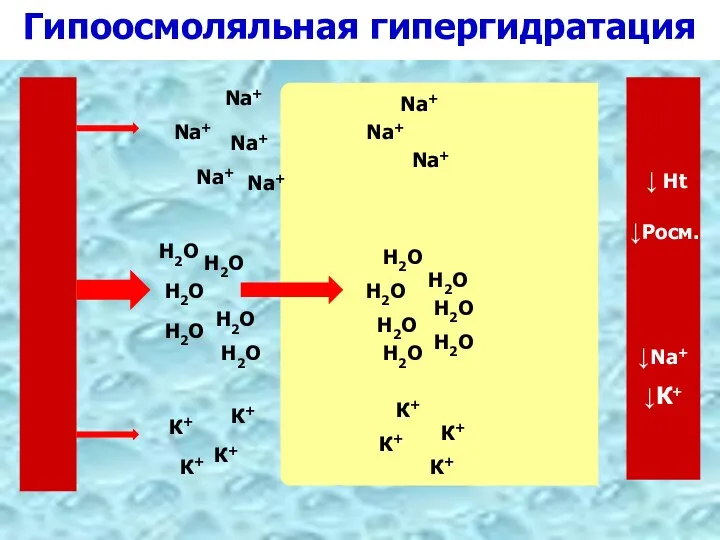 Гипоосмоляльная гипергидратация К+ Na+ Н2О К+ Na+ Н2О Н2О Н2О