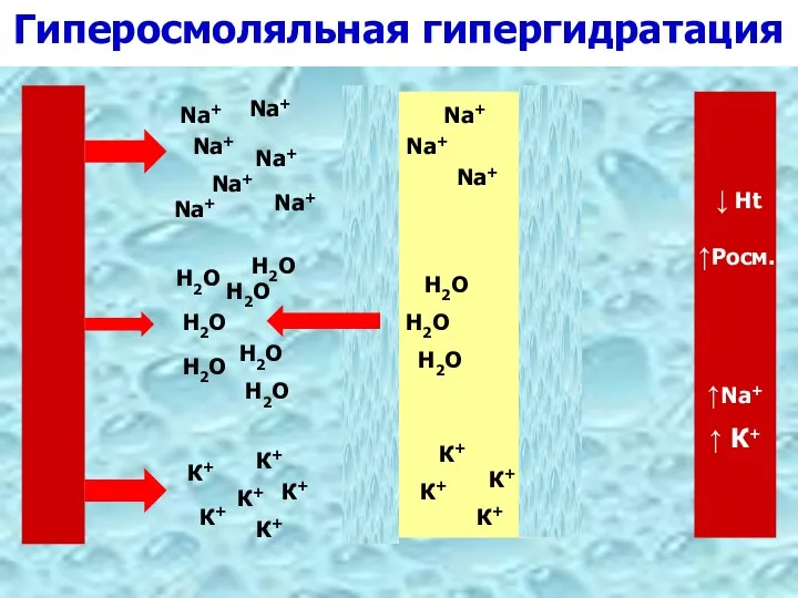 Гиперосмоляльная гипергидратация К+ Na+ Н2О К+ Na+ Н2О Н2О Н2О