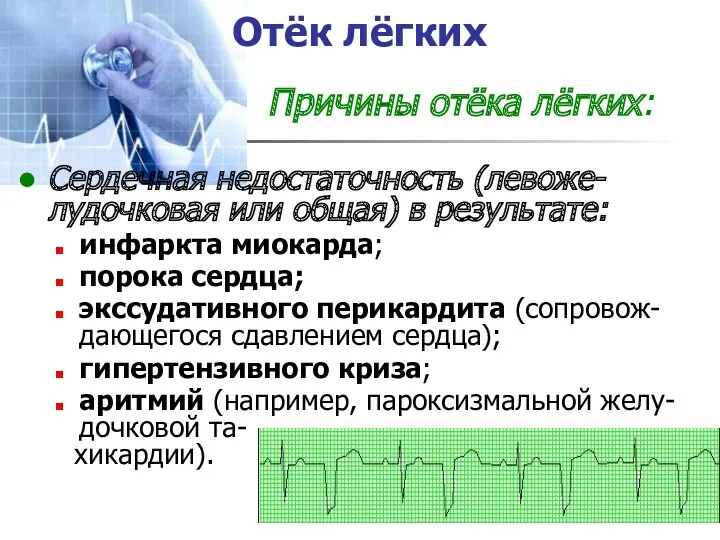 Отёк лёгких Причины отёка лёгких: Сердечная недостаточность (левоже-лудочковая или общая)