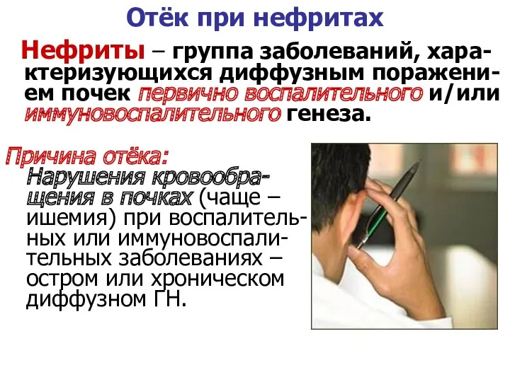 Отёк при нефритах Нефриты – группа заболеваний, хара-ктеризующихся диффузным поражени-ем