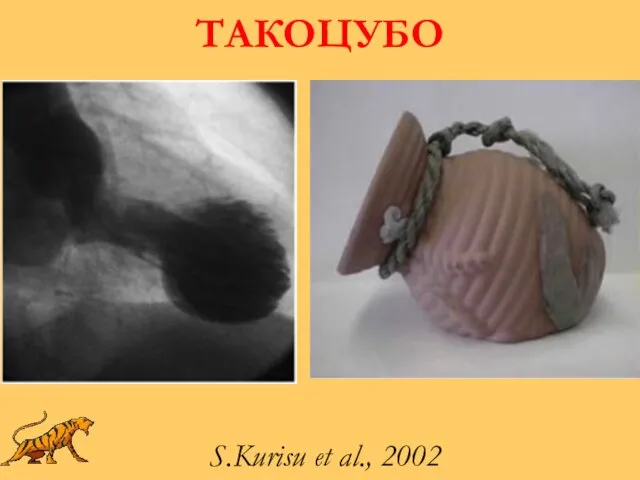 ТАКОЦУБО S.Kurisu et al., 2002