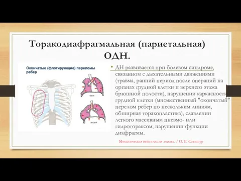 Торакодиафрагмальная (париетальная) ОДН. ДН развивается при болевом синдроме, связанном с дыхательными движениями (травма,