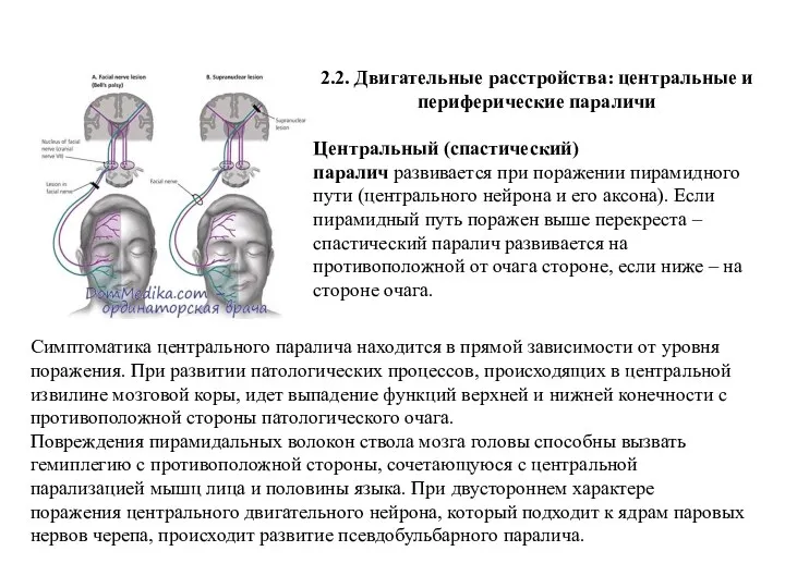 2.2. Двигательные расстройства: центральные и периферические параличи Центральный (спастический) паралич