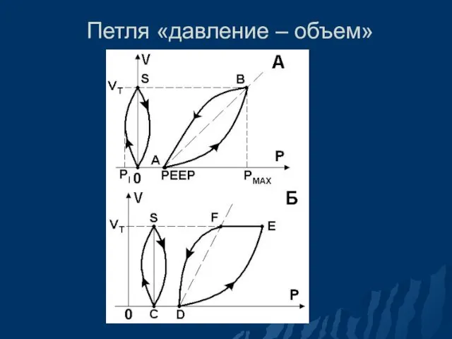 Петля «давление – объем»