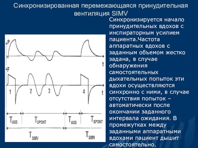 Синхронизированная перемежающаяся принудительная вентиляция SIMV Синхронизируется начало принудительных вдохов с