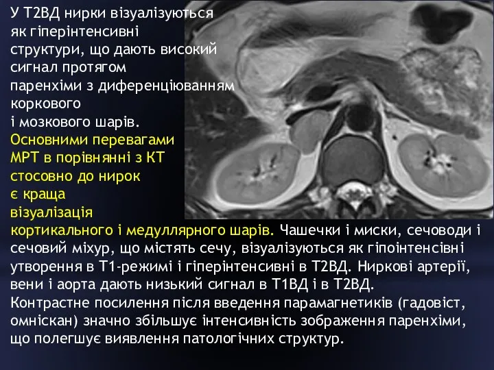 У Т2ВД нирки візуалізуються як гіперінтенсивні структури, що дають високий