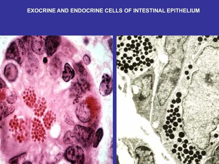 EXOCRINE AND ENDOCRINE CELLS OF INTESTINAL EPITHELIUM