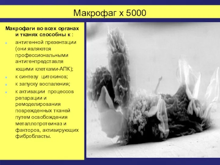 Макрофаг х 5000 Макрофаги во всех органах и тканях способны
