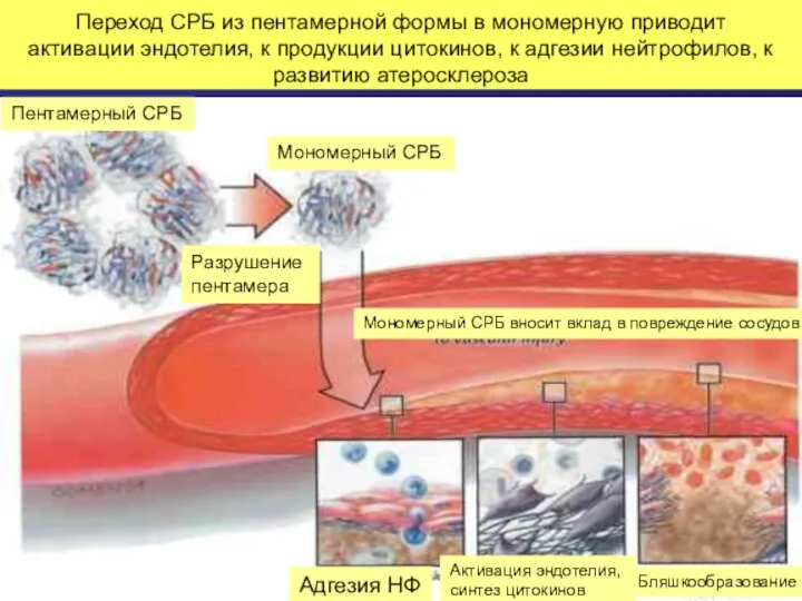 Переход СРБ из пентамерной формы в мономерную приводит активации эндотелия,