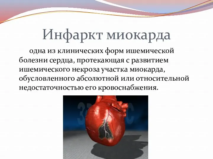 Инфаркт миокарда одна из клинических форм ишемической болезни сердца, протекающая