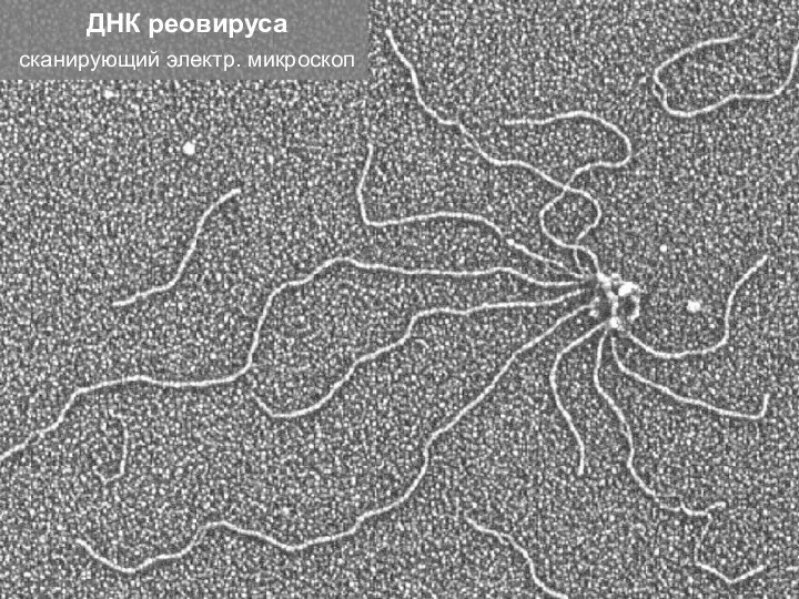 ДНК реовируса сканирующий электр. микроскоп