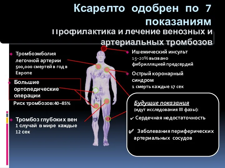 Тромбоэмболия легочной артерии 500,000 смертей в год в Европе Тромбоз