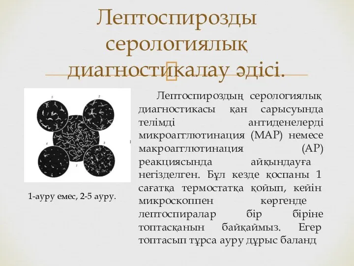 Лептоспироздың серологиялық диагностикасы қан сарысуында телімді антиденелерді микроагглютинация (МАР) немесе