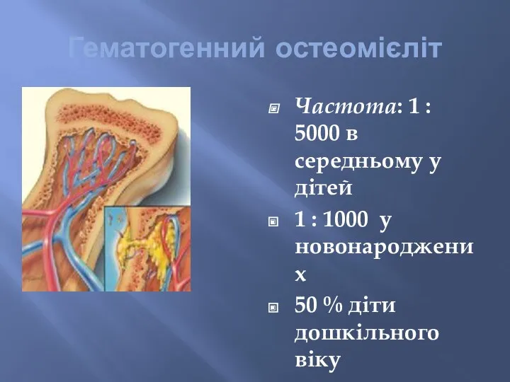 Гематогенний остеомієліт Частота: 1 : 5000 в середньому у дітей