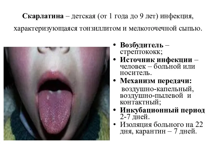 Скарлатина – детская (от 1 года до 9 лет) инфекция,
