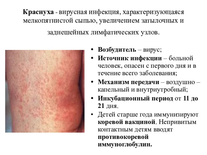 Краснуха - вирусная инфекция, характеризующаяся мелкопятнистой сыпью, увеличением затылочных и