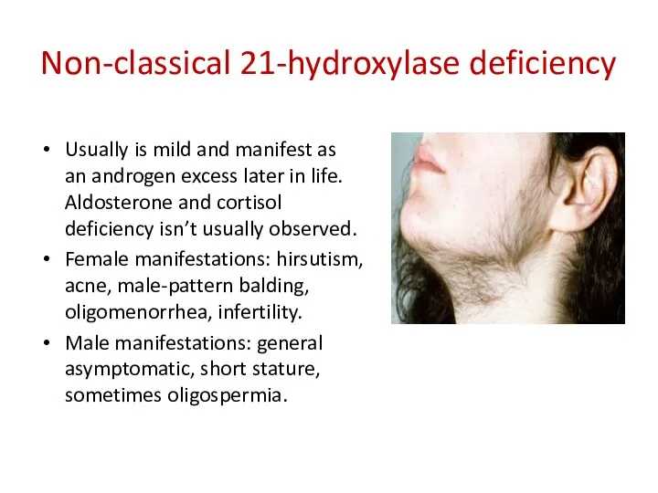 Non-classical 21-hydroxylase deficiency Usually is mild and manifest as an