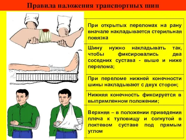 Правила наложения транспортных шин