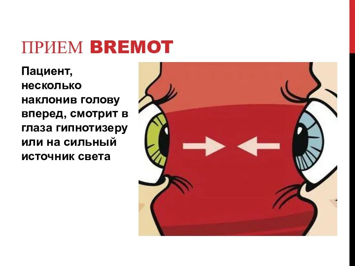 Пациент,несколько наклонив голову вперед, смотрит в глаза гипнотизеру или на сильный источник света ПРИЕМ BREMOT