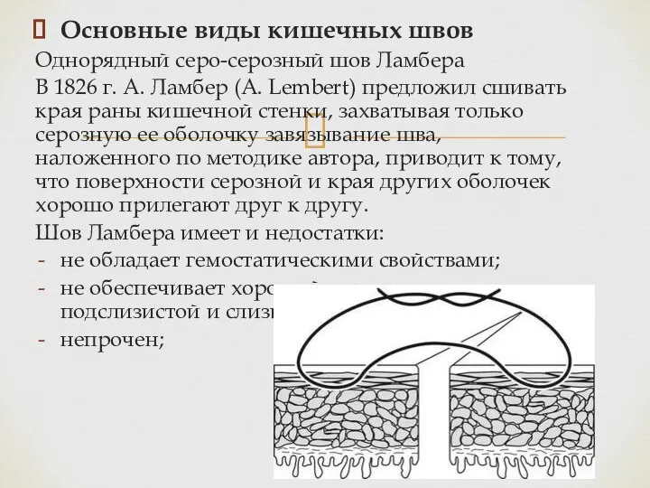 Основные виды кишечных швов Однорядный серо-серозный шов Ламбера В 1826