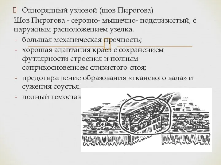 Однорядный узловой (шов Пирогова) Шов Пирогова - серозно- мышечно- подслизистый,