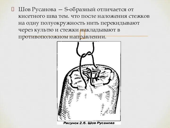 Шов Русанова — S-образный отличается от кисетного шва тем. что