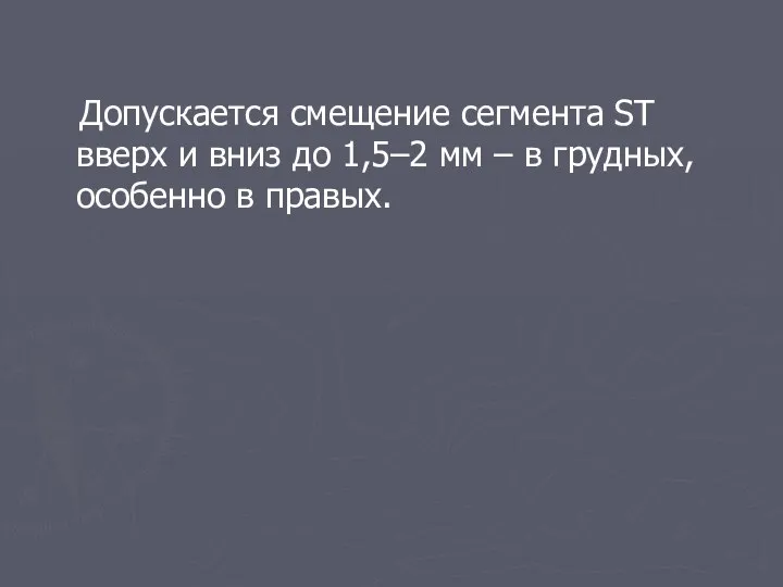 Допускается смещение сегмента ST вверх и вниз до 1,5–2 мм – в грудных, особенно в правых.