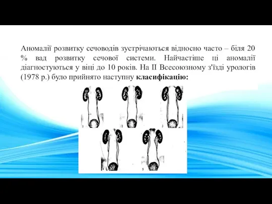 Аномалії розвитку сечоводів зустрічаються відносно часто – біля 20 %