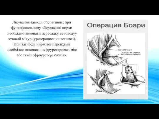 Лікування завжди оперативне: при функціональному збереженні нирки необхідно виконати пересадку