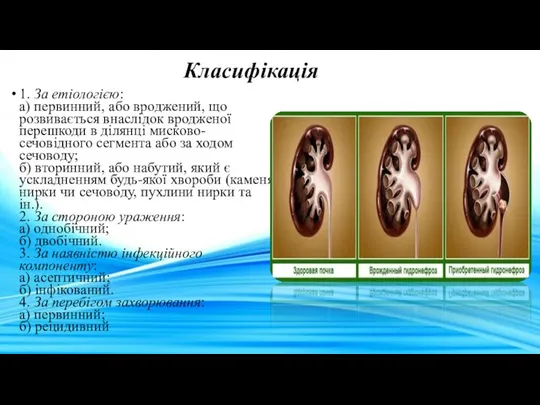 Класифікація 1. За етіологією: а) первинний, або вроджений, що розвивається