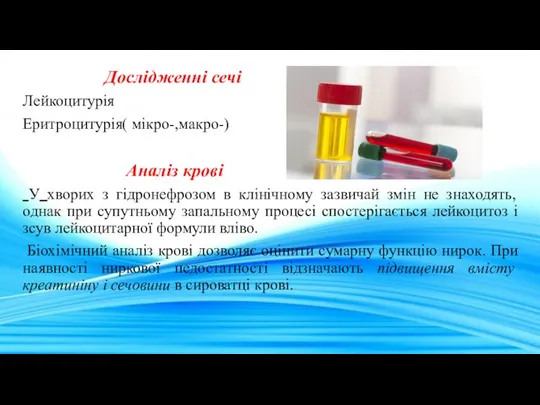 Дослідженні сечі Лейкоцитурія Еритроцитурія( мікро-,макро-) Аналіз крові У хворих з