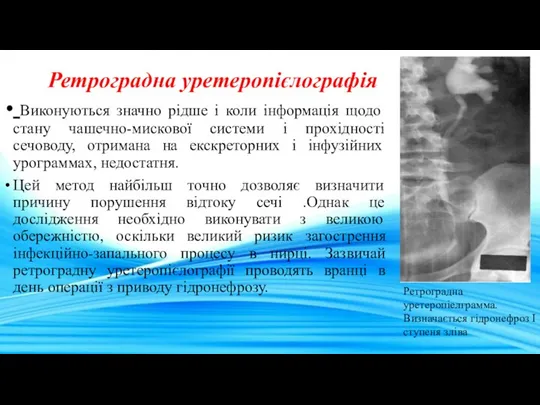 Ретроградна уретеропієлографія Виконуються значно рідше і коли інформація щодо стану