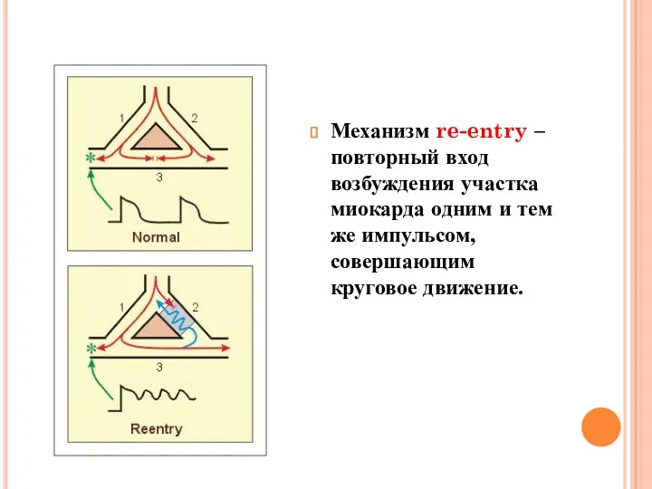 Механизм re-entry – повторный вход возбуждения участка миокарда одним и тем же импульсом, совершающим круговое движение.