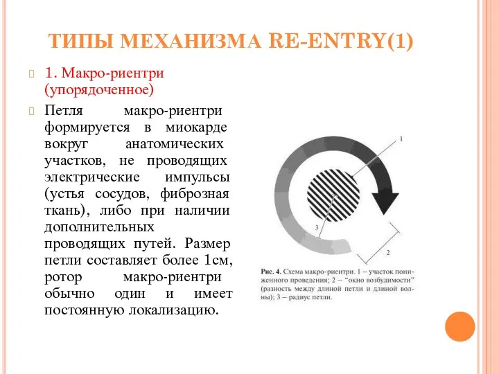 ТИПЫ МЕХАНИЗМА RE-ENTRY(1) 1. Макро-риентри (упорядоченное) Петля макро-риентри формируется в