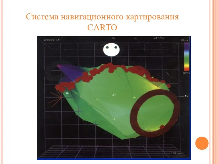 Система навигационного картирования CARTO