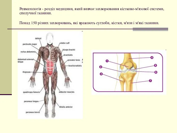 Ревматологія - розділ медицини, який вивчає захворювання кістково-м'язової системи, сполучної