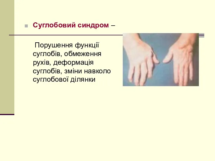 Суглобовий синдром – Порушення функції суглобів, обмеження рухів, деформація суглобів, зміни навколо суглобової ділянки