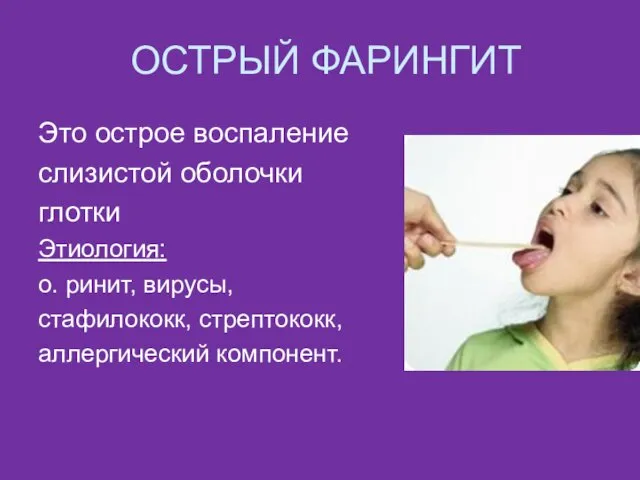 ОСТРЫЙ ФАРИНГИТ Это острое воспаление слизистой оболочки глотки Этиология: о. ринит, вирусы, стафилококк, стрептококк, аллергический компонент.