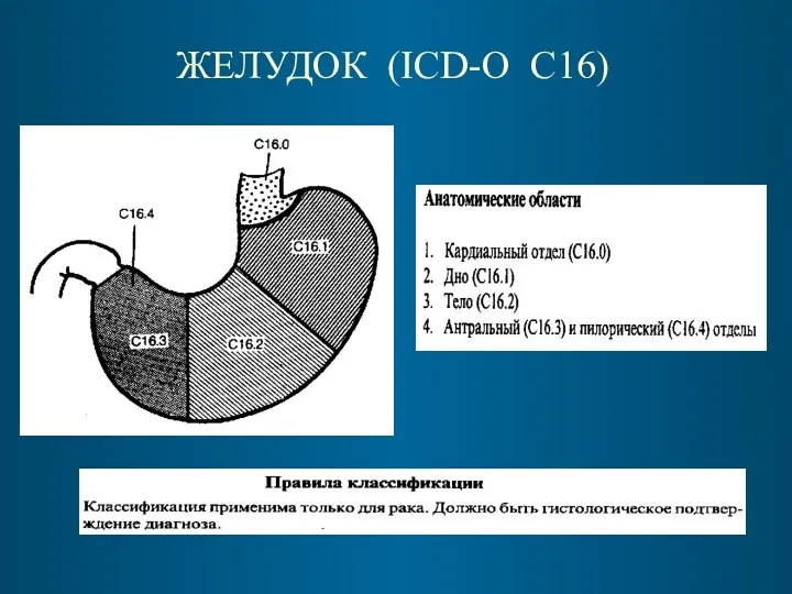 ЖЕЛУДОК (ICD-O C16)