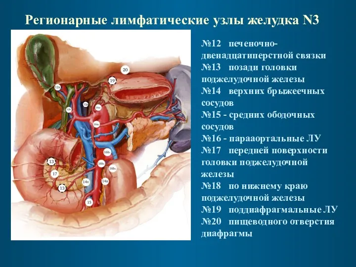 Регионарные лимфатические узлы желудка N3 №12 печеночно-двенадцатиперстной связки №13 позади