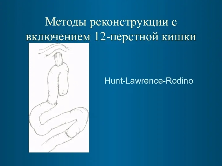 Методы реконструкции с включением 12-перстной кишки Hunt-Lawrence-Rodino