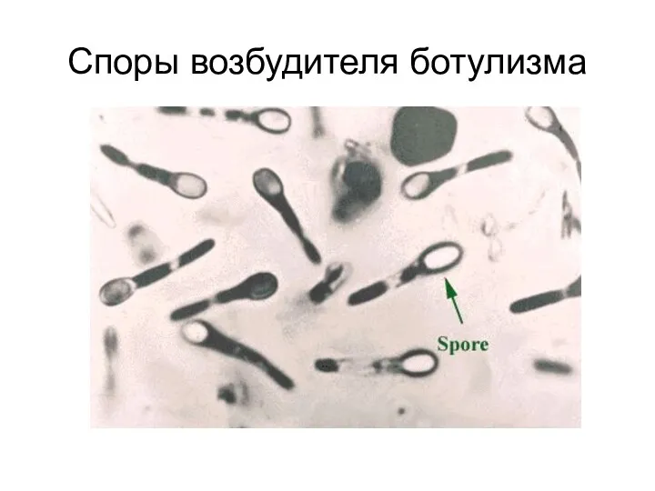 Споры возбудителя ботулизма