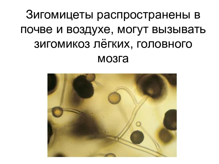 Зигомицеты распространены в почве и воздухе, могут вызывать зигомикоз лёгких, головного мозга
