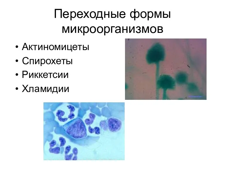 Переходные формы микроорганизмов Актиномицеты Спирохеты Риккетсии Хламидии