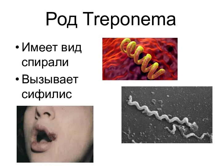 Род Treponema Имеет вид спирали Вызывает сифилис