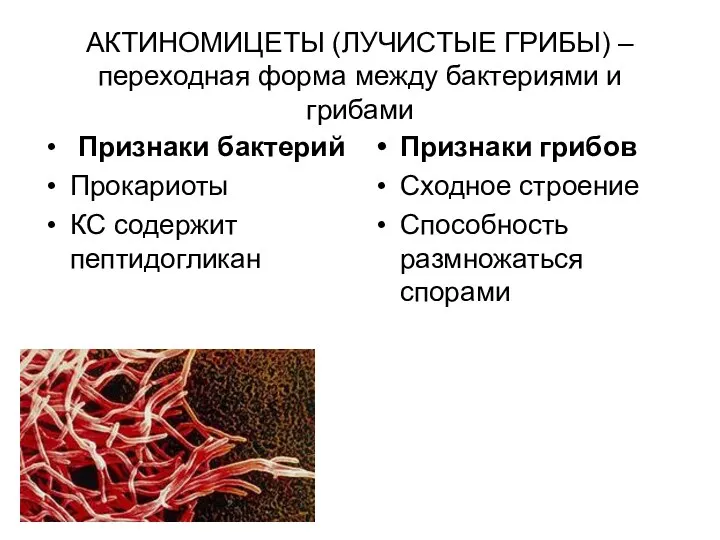 АКТИНОМИЦЕТЫ (ЛУЧИСТЫЕ ГРИБЫ) – переходная форма между бактериями и грибами