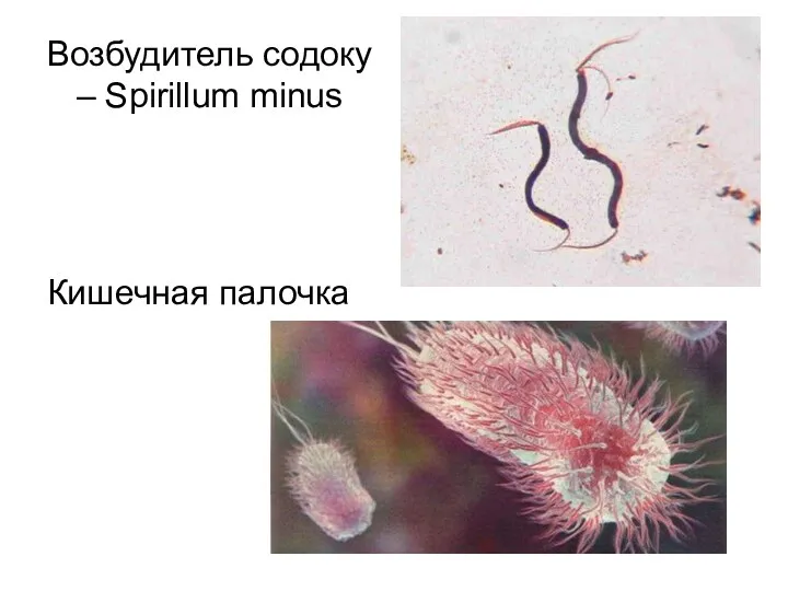 Возбудитель содоку – Spirillum minus Кишечная палочка